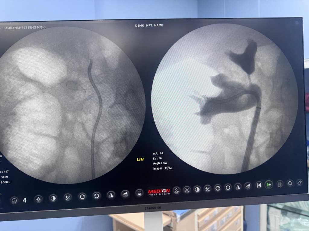 Dual-view fluoroscopic monitoring of urological procedure